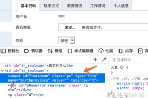 OP突发安全漏洞，亏损多达284万美元！的简单介绍-ayx sports